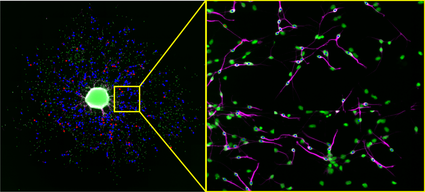 The left image shows two point clouds of all identified neurons of an automated evaluation (red) and a manual evaluation (blue). Since equal positions are overlapped (red dots are overlapped with blue dots), the user is able to see coordinates of falsely identified neurons, and again a close up (right image) helps to judge the quality of the automated evaluation.