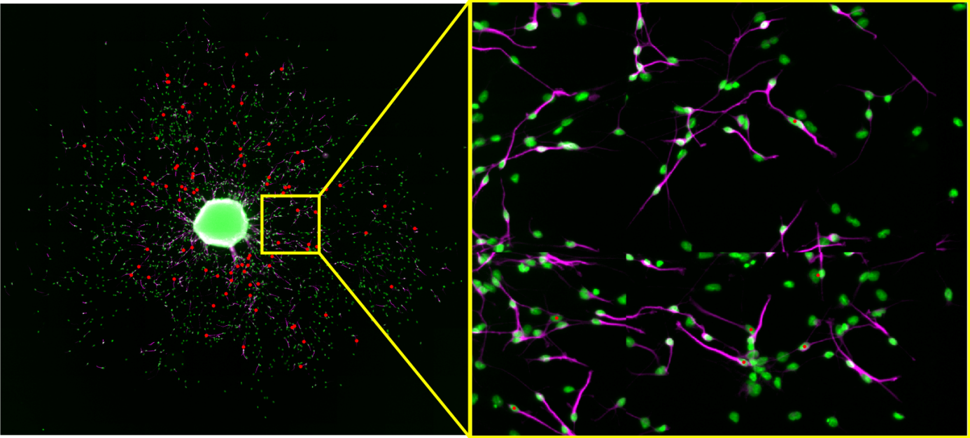 The left image shows positions of non identified neurons (red dots) on the overview image. The left image is a close up of a small extract showing several neurons which were not identified by the algorithm (red dots)or only those which are falsely identified by the algorithm (false positives).