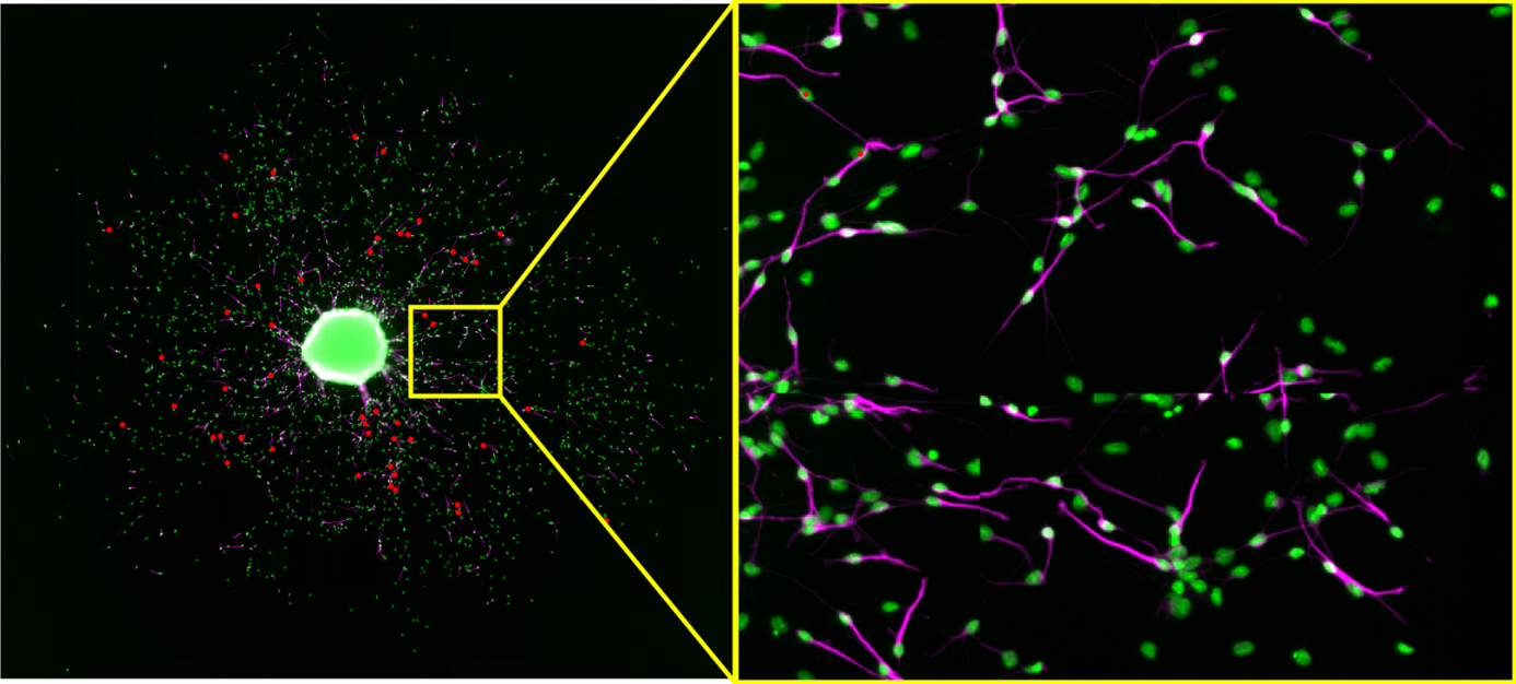 The left image shows positions of falsely identified neurons (red dots) on the overview image. The right image is a close up of a small extract showing several neurons which were identified by the algorithm (red dots), but not by the manual evaluation.