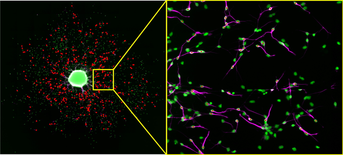The left image shows the point cloud of all identified neurons of an automated evaluation. Within the user interface it is possible to zoom into certain regions to judge how accurate the neuronal identification performed.